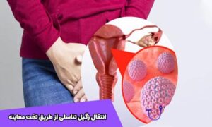 آیا زگیل تناسلی از شلنگ دستشویی منتقل میشود