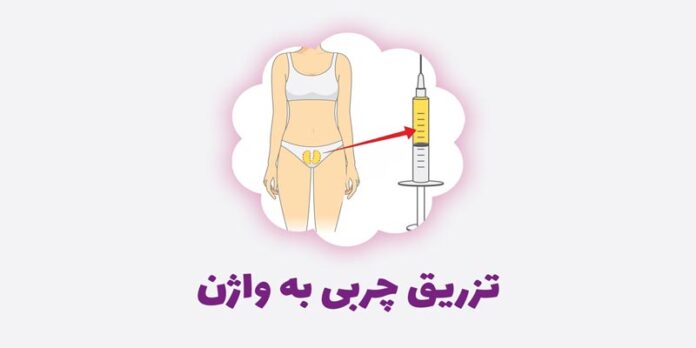 عوارض تزریق ژل به واژن